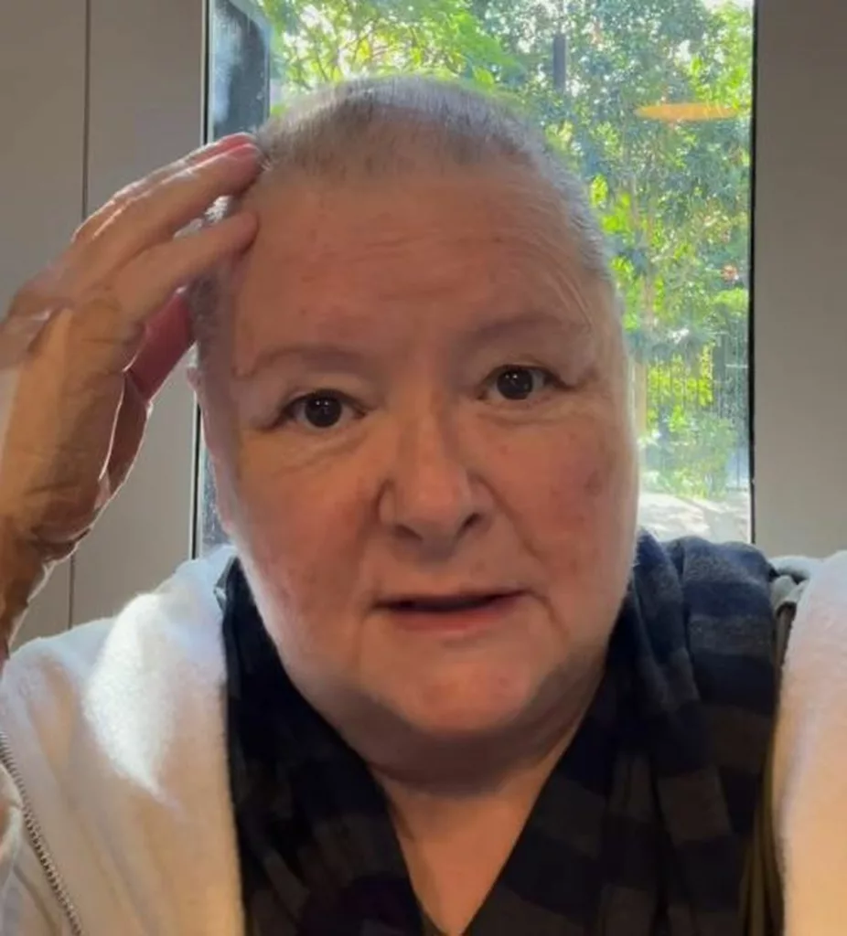 Magda Szubanski ritka és gyorsan terjedő rákkal küzd